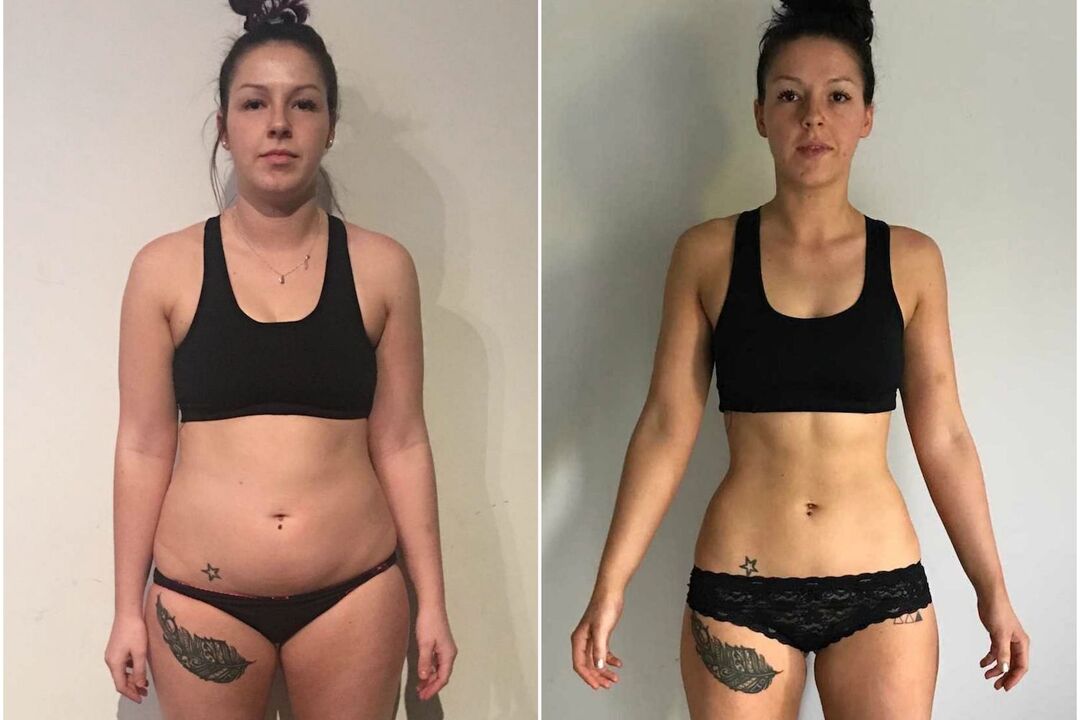 prima e dopo la perdita di peso